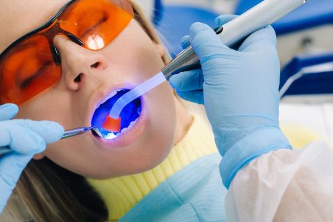 Dental Bonding
