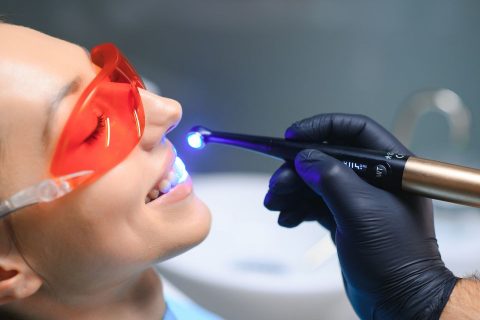 Teeth Whitening